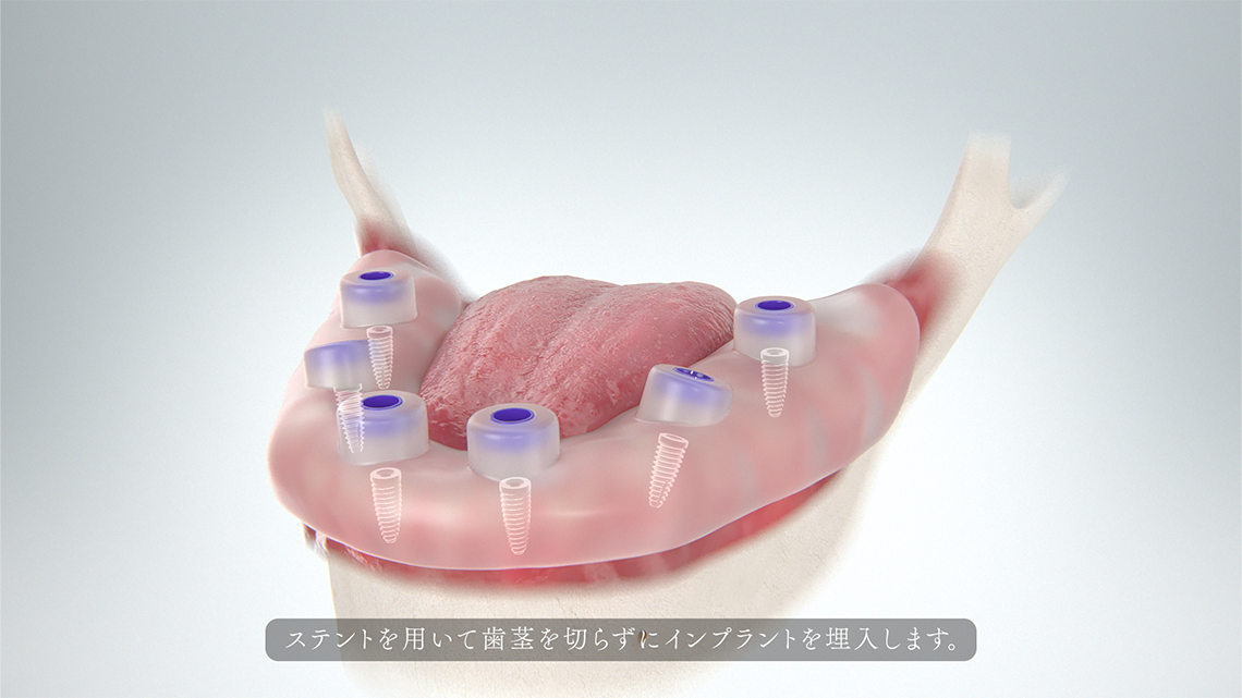 ADCの画像3